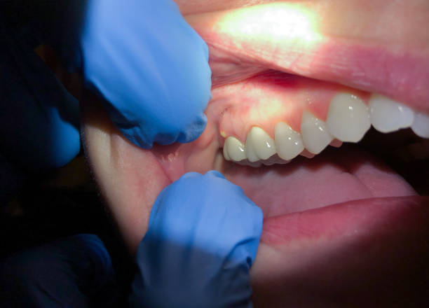 Best 24-Hour Emergency Dental Care in Forestde, AL