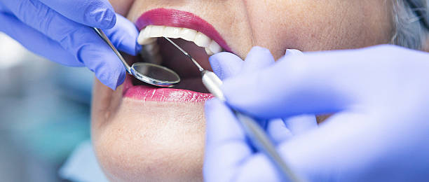 Best Emergency Wisdom Tooth Extraction in Forestde, AL